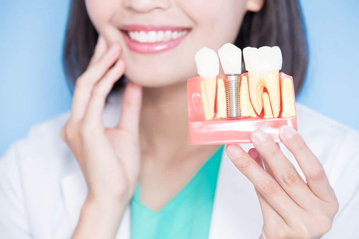 Featured image for “What to Expect With Dental Implants”