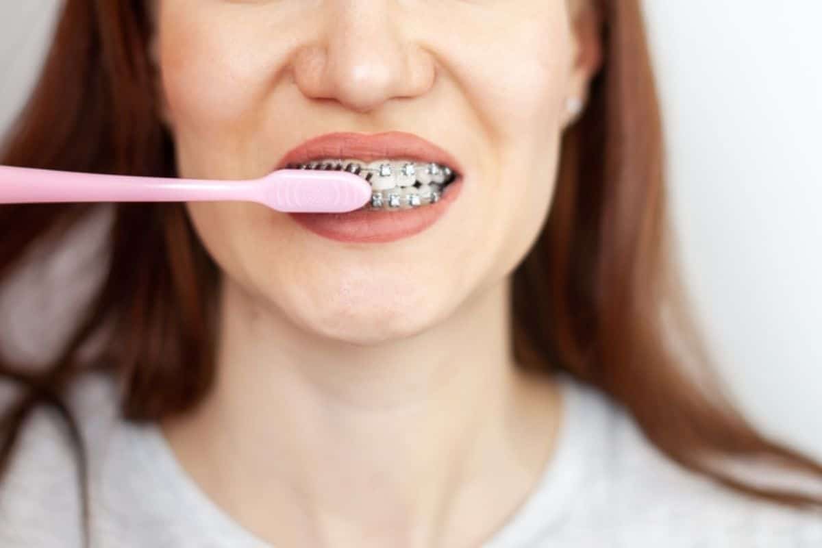 Featured image for “How to Clean Your Teeth With Braces”