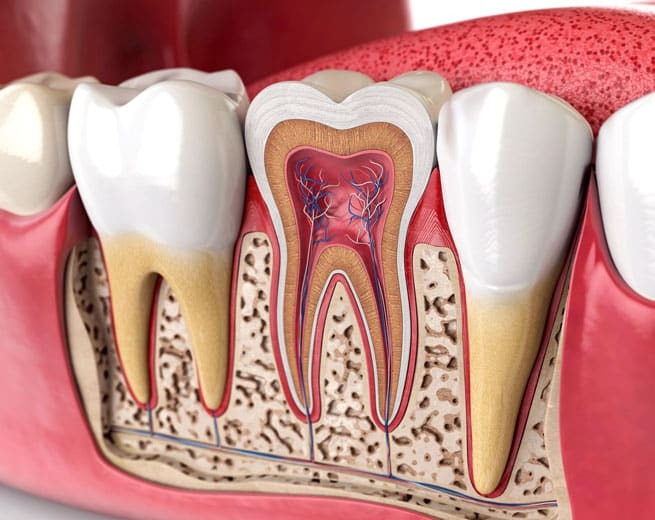 Dental anatomy cross-section showing tooth structure with pulp chamber, dentin, enamel, and bone.
