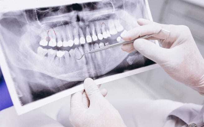 Dentist examining panoramic X-ray of patient's teeth and jaw structure in clinical setting.