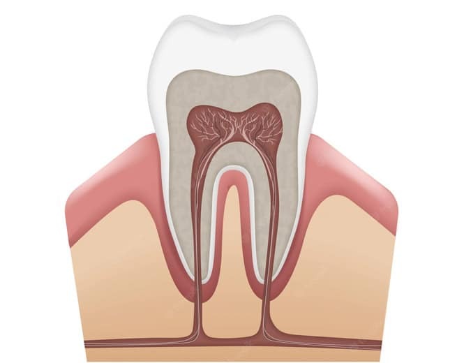 Tooth cross-section diagram showing pulp chamber, root canals, and nerve tissue requiring retreatment.