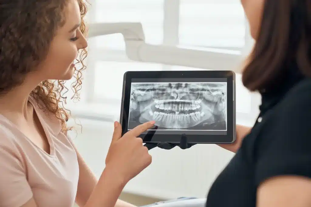 Featured image for “Osseointegration and Dental Implant Treatment”