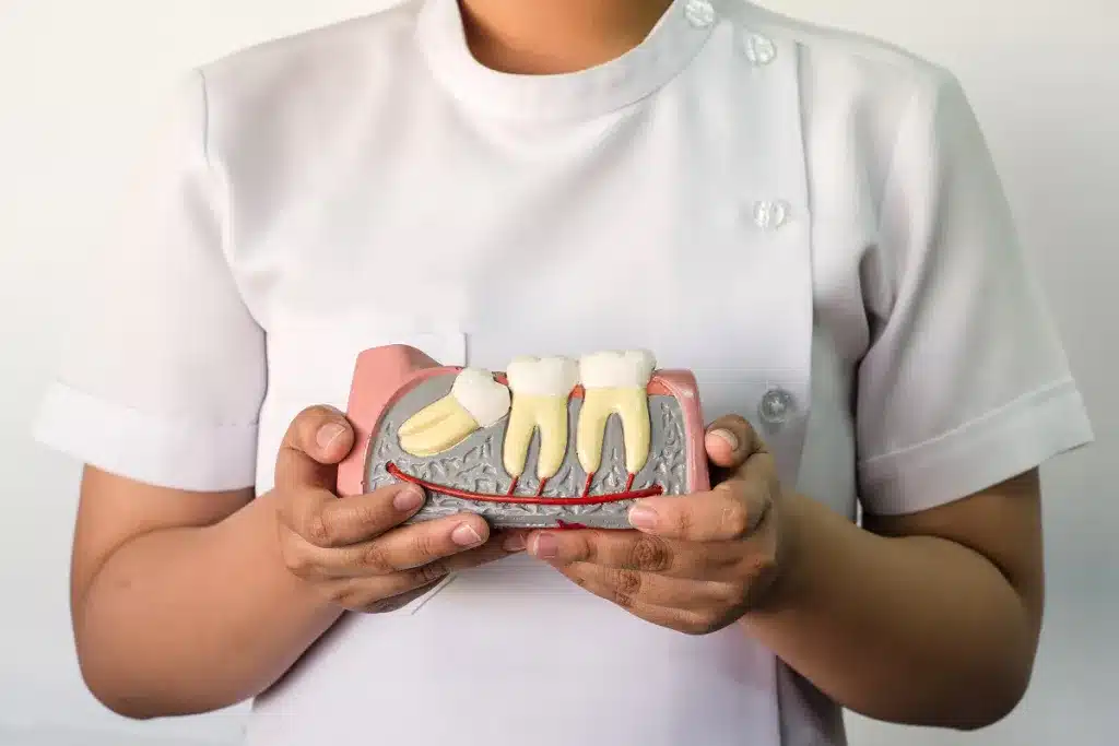 Featured image for “What Happens When Wisdom Teeth Are Impacted?”