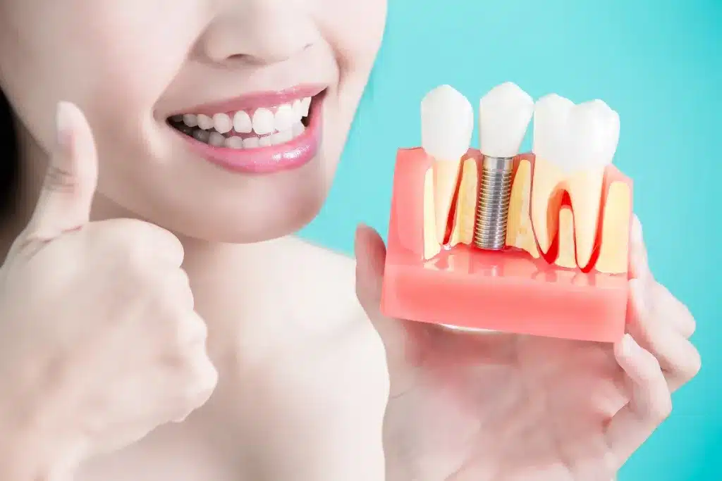 Featured image for “Dental Implant Placement vs. Implant Restoration: What’s the Difference?”