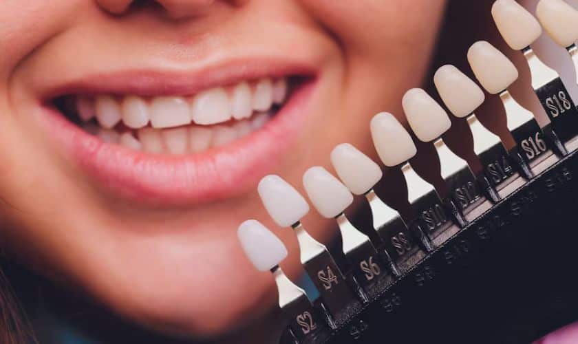 Featured image for “Porcelain Veneers for Sensitive Teeth: Addressing Concerns and Solutions”
