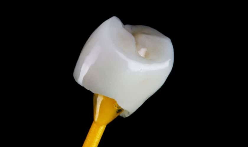 Featured image for “Common Myths About Dental Crowns: Debunking Misconceptions”