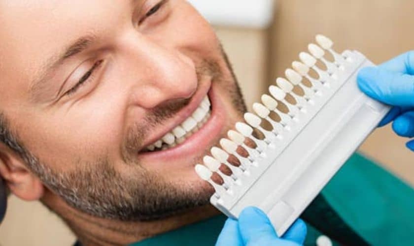 Featured image for “Best Tips for Caring for Your Porcelain Veneers”
