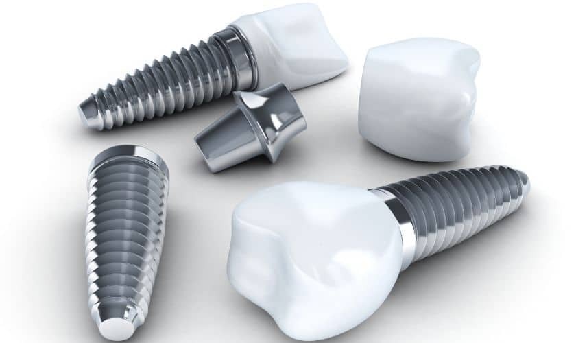 Featured image for “Strategies to Enhance Bone Density for Effective Dental Implant Placement”