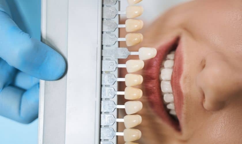 Featured image for “Porcelain Veneers and Bite Alignment: Improving Functionality”