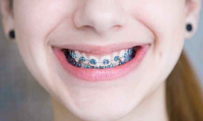 Featured image for “Tips for Choosing the Right Orthodontist for Your Braces Journey”
