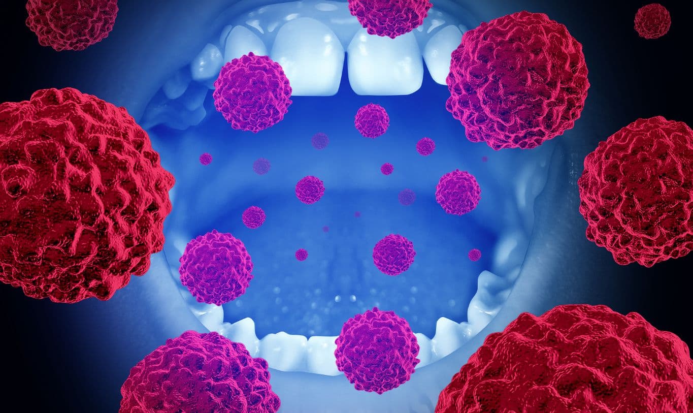 Featured image for “Brush Up on Your Health: How Oral Hygiene Can Impact Oral Cancer Risk”