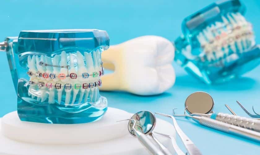 Featured image for “Straight Teeth, Healthy Smile: Unveiling the Dental Benefits of Orthodontics”