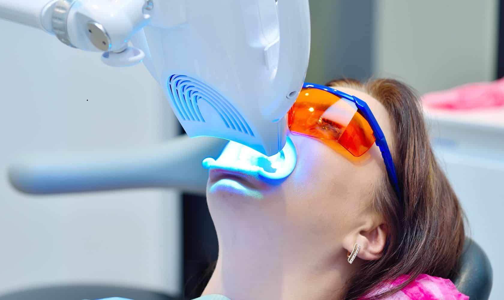 Featured image for “Brighten Your Smile: Unveiling the Best Teeth Whitening Options!”