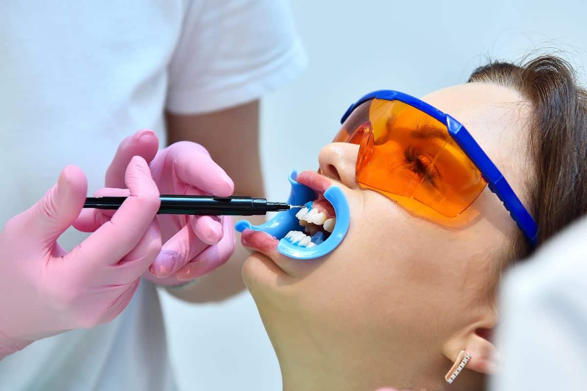 Featured image for “5 Essential Facts About Teeth Whitening You Need to Know”
