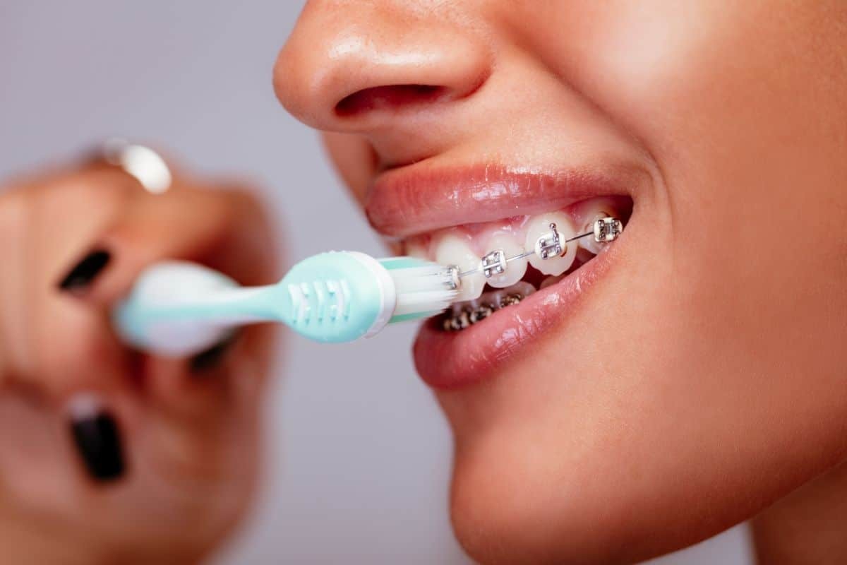 Featured image for “Top Ways to Make Your Braces Journey More Comfortable”