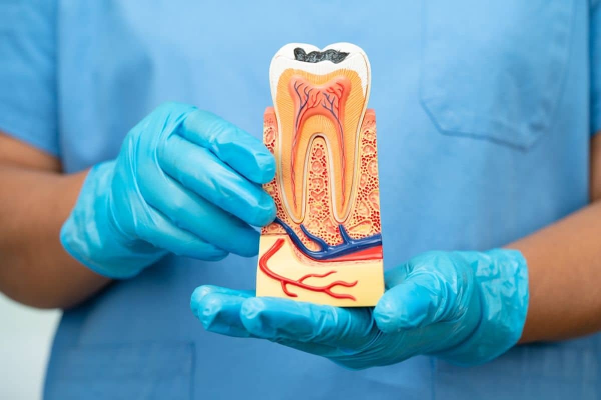 Featured image for “What to Expect Before and After a Root Canal Treatment?”