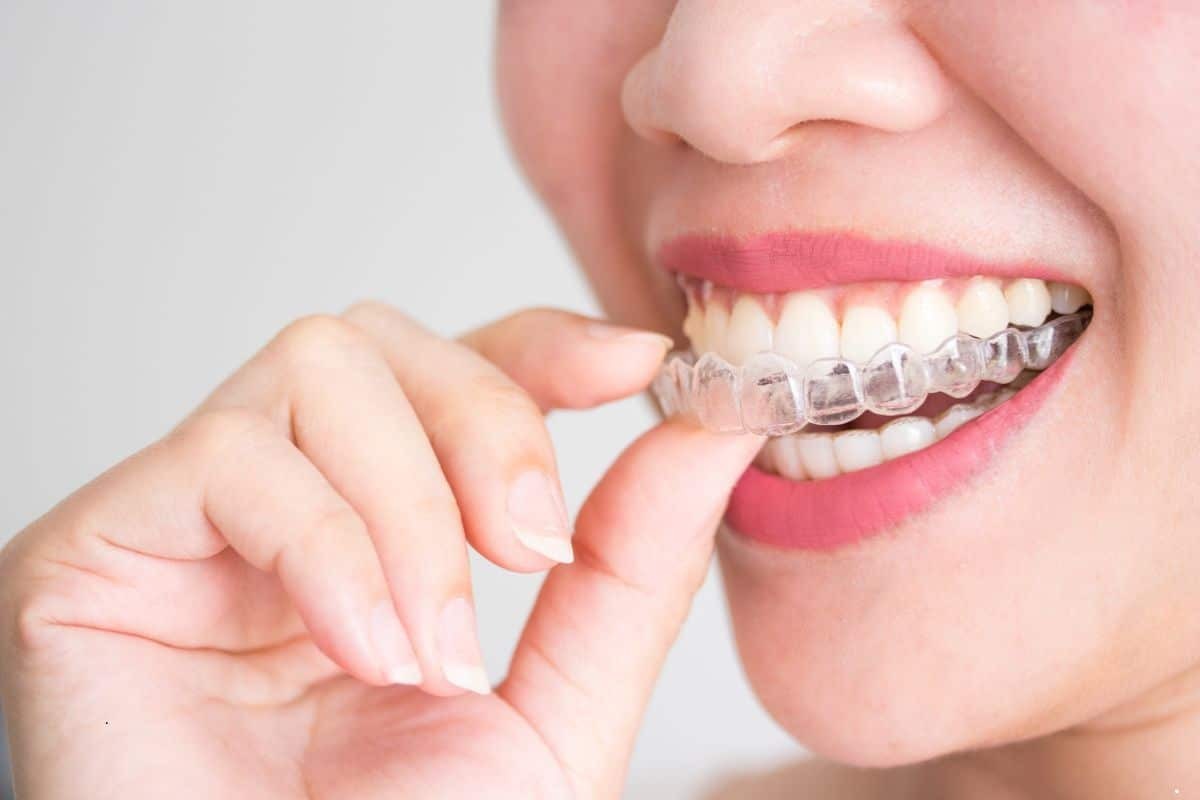 Featured image for “How to Take Care of Your Invisalign: 5 Essential Tips”