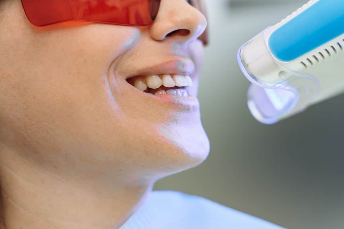Featured image for “How Professional Teeth Whitening Creates a Big Difference with Small Changes”