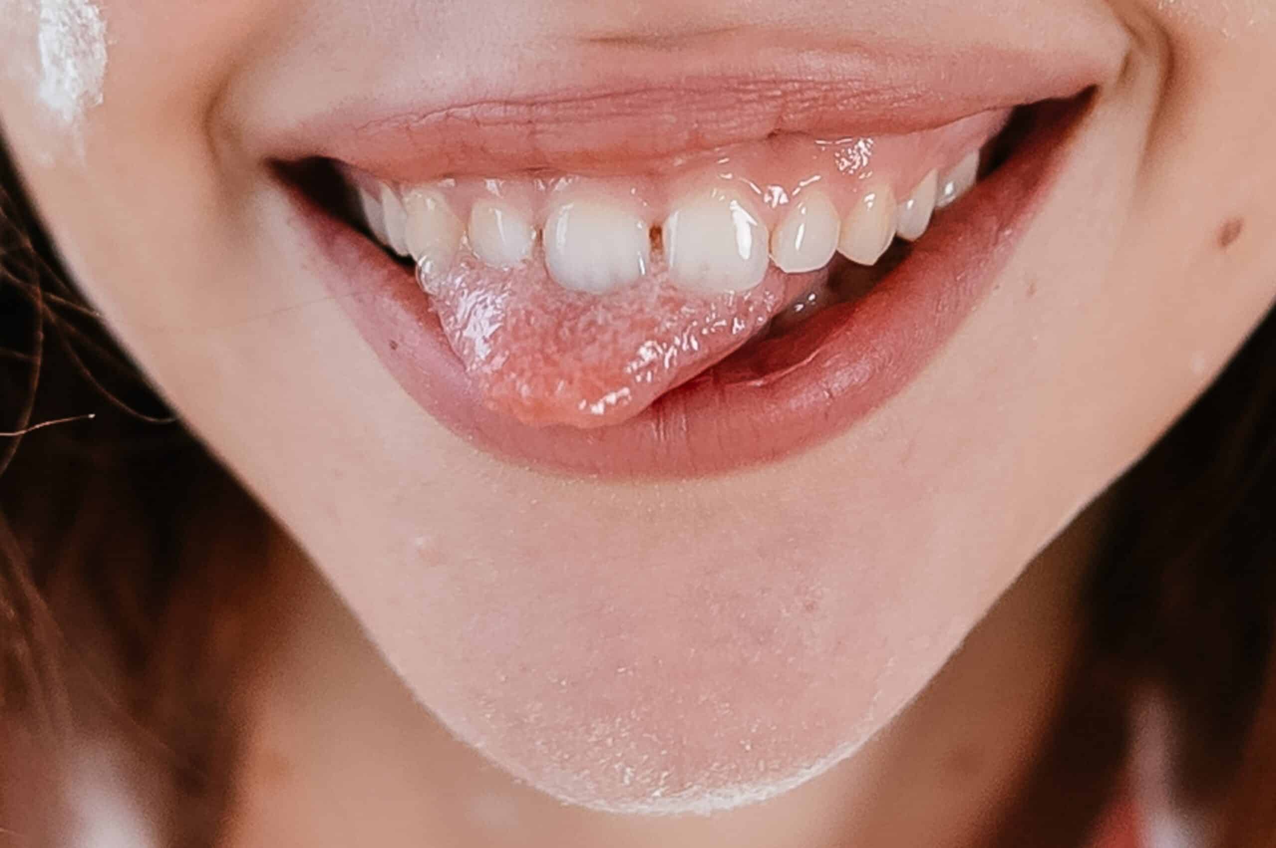 Featured image for “Are Small Gaps Between Teeth a Dental Problem?”