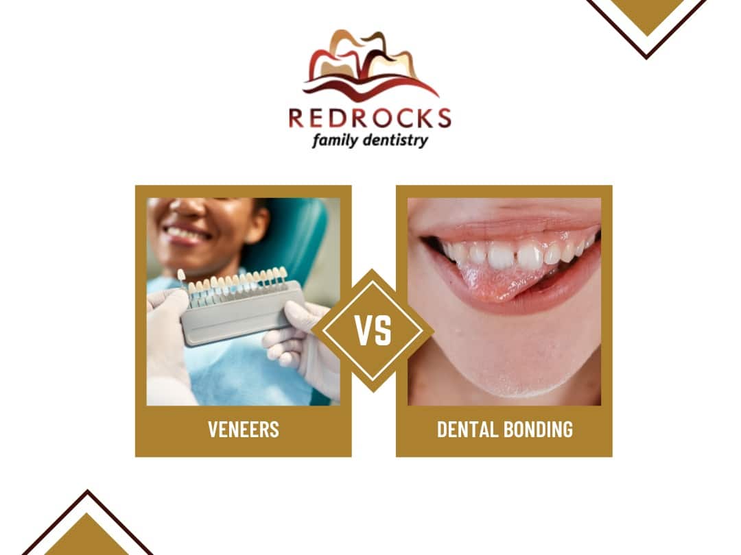 Featured image for “Veneers vs. Dental Bonding: Which Cosmetic Option Is Right for You?”